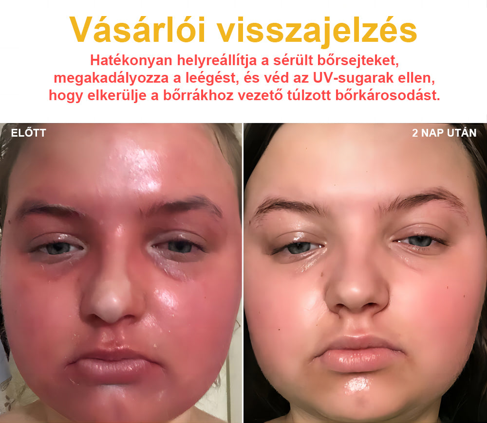 đđBSWELLÂź MĂ©hmĂ©reg KezelĂ©s KrĂ©mđšââïžïŒAAD ajĂĄnlottïŒ (đ„utolsĂł nap promĂłciĂł 80% kiïŒ