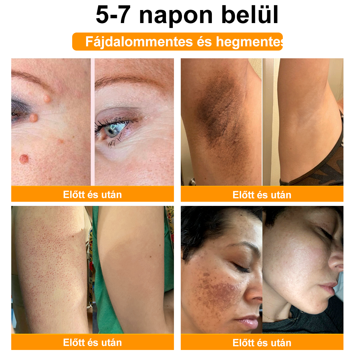 đđ Csak 5 ĂŒveg maradt! TovĂĄbbi 50% kedvezmĂ©nyt kĂnĂĄlunk! FormĂĄld magad Ă©s lĂ©gy egĂ©szsĂ©ges. Ha most lemaradsz, jövĆre nem lesz Ășjabb lehetĆsĂ©ged.