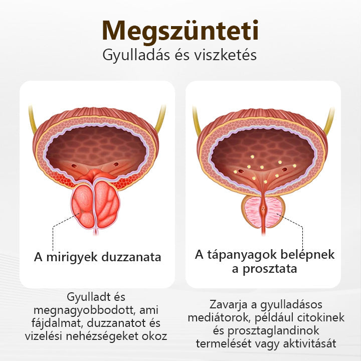 A szexuális teljesítmény csökkenése frusztráló lehet, és hatással van Önre és a partnerére. A termékünk segíthet visszanyerni az önbizalmát, és helyreállítani a kapcsolatukat. 180 napos pénzvisszafizetési garancia!