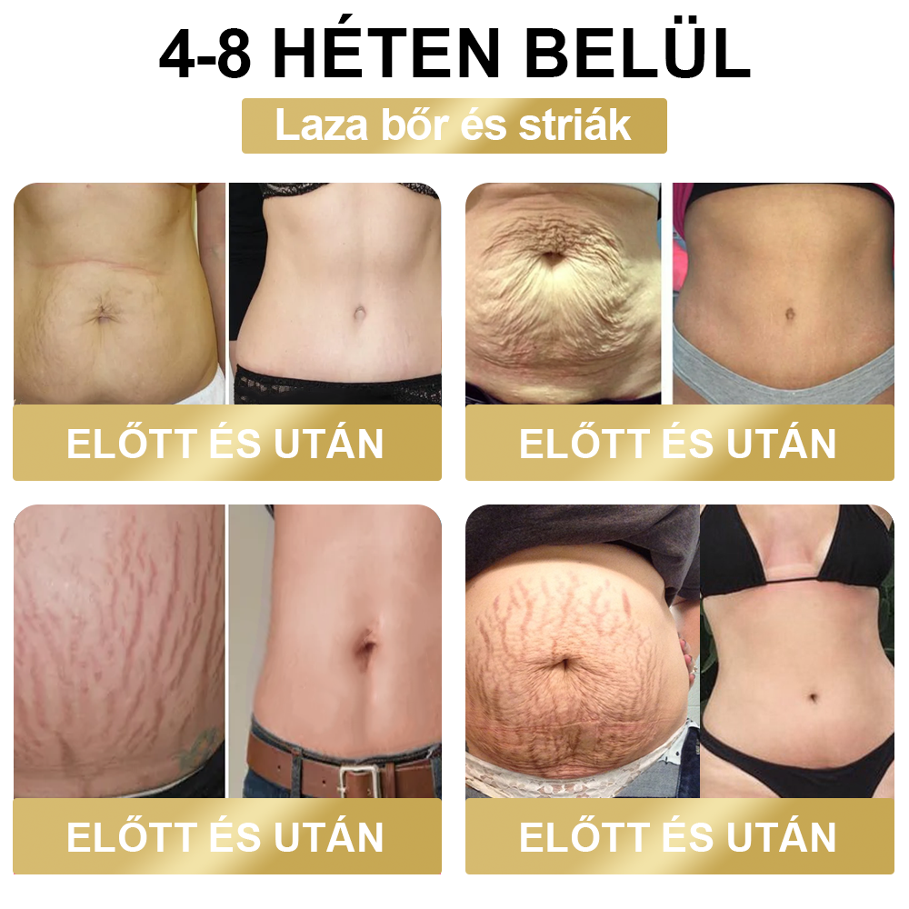 🎁A mennyiség már nem sok, neked adjuk a legalacsonyabb kedvezményt. Ragadd meg ezt a lehetőséget, ne hagyd ki!