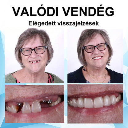 🌤️𝑺𝒎𝒊𝒍𝒆𝒉𝒑𝒚™ 𝑺𝒛𝒊𝒍𝒊𝒌𝒐𝒏 𝑭𝒐𝒈𝒔𝒐𝒓 𝑨𝒍á𝒃é𝒍𝒆𝒍ő 𝑲é𝒔𝒛𝒍𝒆𝒕