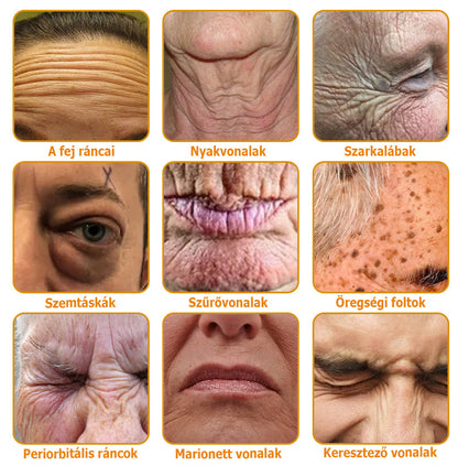 (🎁2025-ös promóció🎁 50% Kedvezmény🎁)Allybee® Botox Bőrápoló Krém US Bőrgyógyászatilag elfogadott