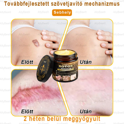 (🎁2025-ös promóció🎁 50% Kedvezmény🎁)Allybee® Botox Bőrápoló Krém US Bőrgyógyászatilag elfogadott