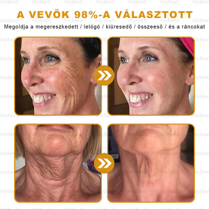 (🎁2025-ös promóció🎁 50% Kedvezmény🎁)Allybee® Botox Bőrápoló Krém US Bőrgyógyászatilag elfogadott