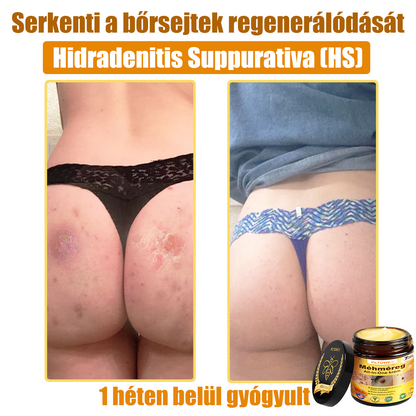 (🎁2025-ös Újévi Akció🎁 50% Kedvezmény🎁)PLTOWE® Méhméreg All-in-One krém US Bőrgyógyászatilag elfogadott