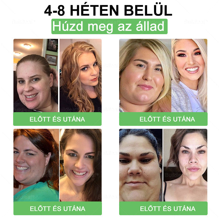 🇭🇺 Klinikai kutatásokkal igazolt | A BuildLeaf® Berberine GLP-1 Pro Súlycsökkentő Szájon át szedhető oldat segíthet a makacs súlytöbblet, anyagcsere- és energiaproblémák kezelésében, támogatva a jobb közérzetet és vitalitást