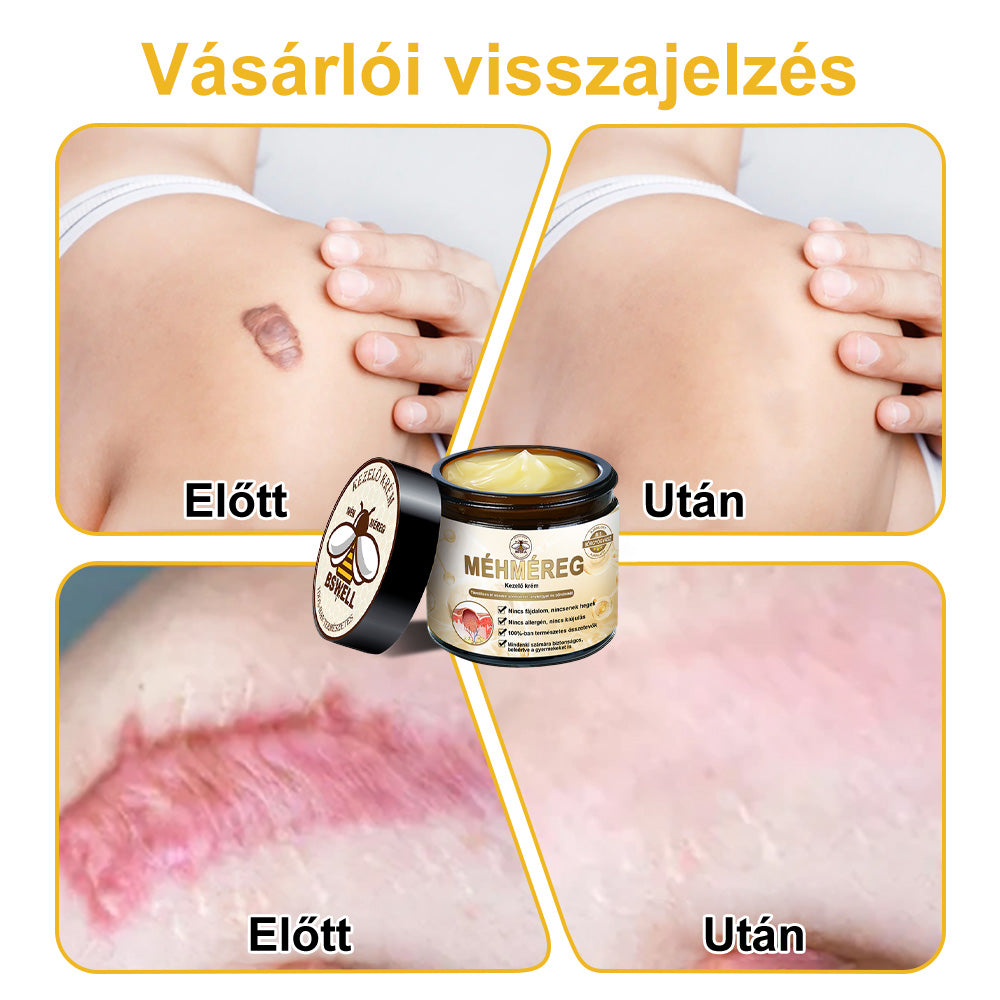 🐝💖 Csak 5 üveg maradt! További 50% kedvezményt kínálunk! Formáld magad és légy egészséges. Ha most lemaradsz, jövőre nem lesz újabb lehetőséged.
