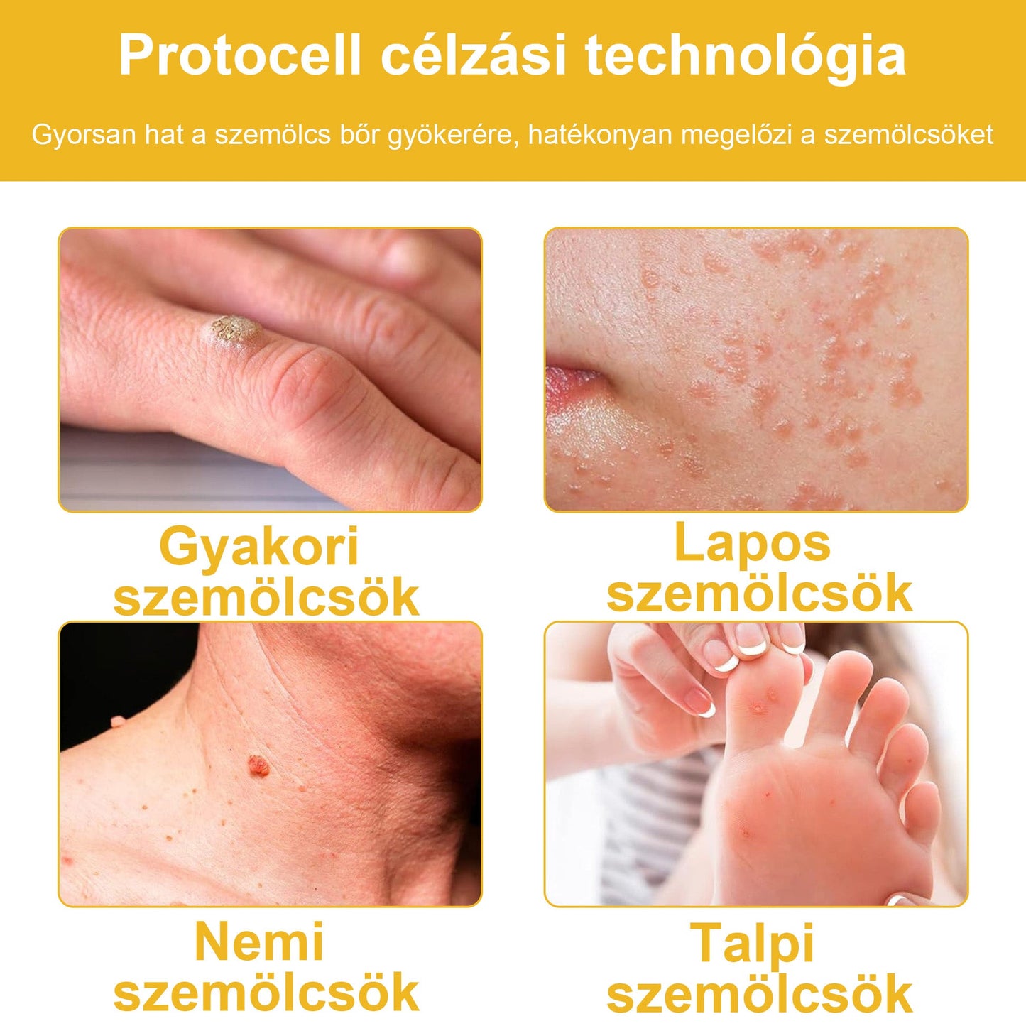 🐝💖 Csak 5 üveg maradt! További 50% kedvezményt kínálunk! Formáld magad és légy egészséges. Ha most lemaradsz, jövőre nem lesz újabb lehetőséged.