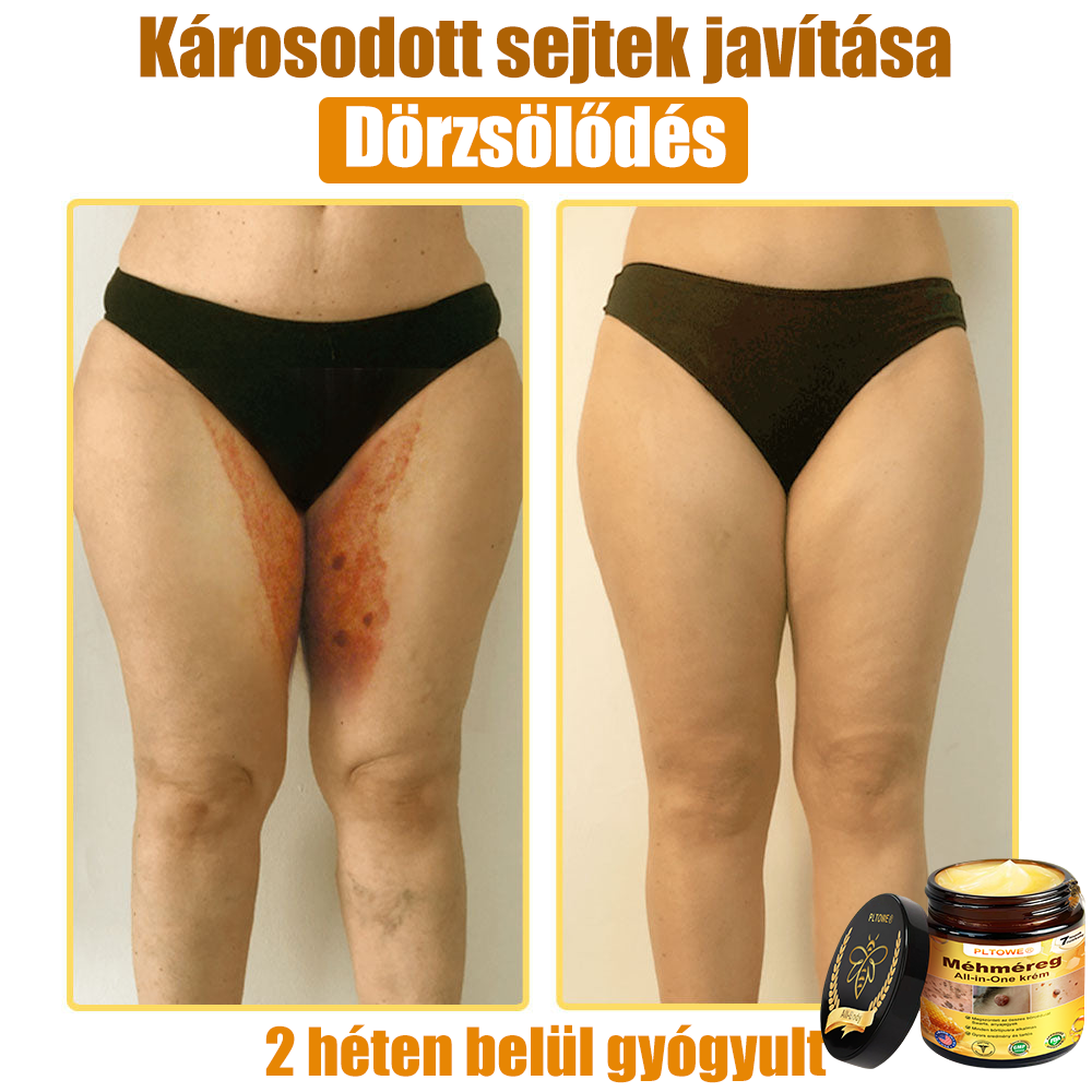 (🎁2025-ös Újévi Akció🎁 50% Kedvezmény🎁)PLTOWE® Méhméreg All-in-One krém US Bőrgyógyászatilag elfogadott