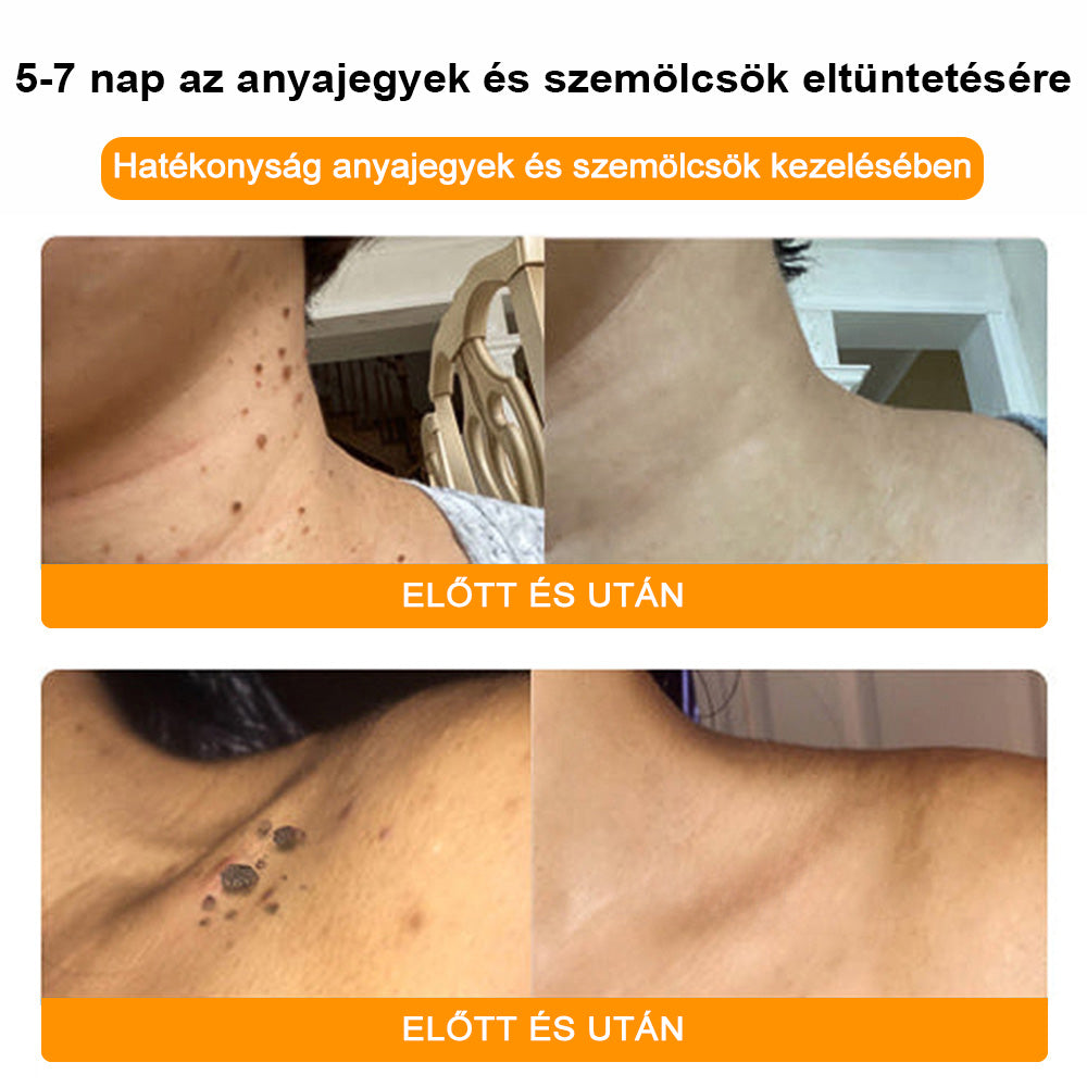 🐝💖 Csak 5 üveg maradt! További 50% kedvezményt kínálunk! Formáld magad és légy egészséges. Ha most lemaradsz, jövőre nem lesz újabb lehetőséged.