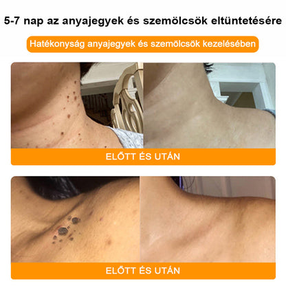 🐝💖 Csak 5 üveg maradt! További 50% kedvezményt kínálunk! Formáld magad és légy egészséges. Ha most lemaradsz, jövőre nem lesz újabb lehetőséged.