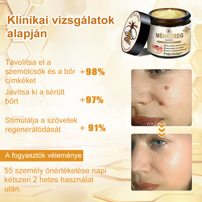 🐝💖 Csak 5 üveg maradt! További 50% kedvezményt kínálunk! Formáld magad és légy egészséges. Ha most lemaradsz, jövőre nem lesz újabb lehetőséged.
