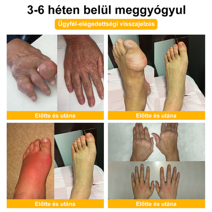 🎁Csak 5 üveg maradt! További 50% kedvezményt kínálunk! Formáld magad és légy egészséges. Ha most lemaradsz, jövőre nem lesz újabb lehetőséged.