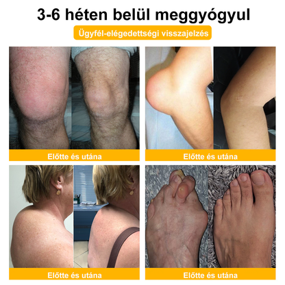 🎁Csak 5 üveg maradt! További 50% kedvezményt kínálunk! Formáld magad és légy egészséges. Ha most lemaradsz, jövőre nem lesz újabb lehetőséged.